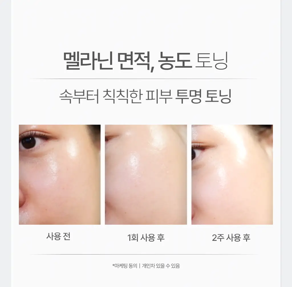 [멜라제로/11가지 비타민 미백케어]가쉬 10초 마이크로 버블팩 퍼펙트 멜라제로 150회분 상세페이지 9